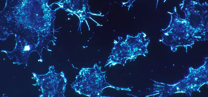 Israeli Scientists Say They’ll Have Cancer Cure in Next Year
